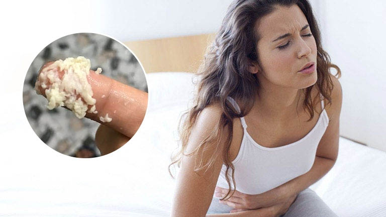 Khí Hư Màu Trắng Vón Cục: Nguyên Nhân và Cách Điều Trị